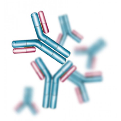 pAb Rabbit anti-Human Amyloid beta peptide 42