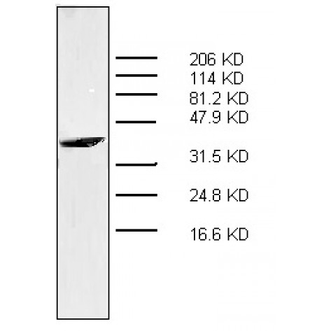 mAb anti-Human S100A7 (psoriasin), 5C2