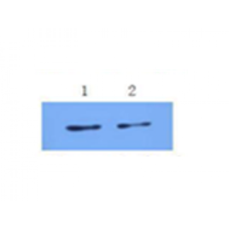 mAb anti-Human IL-6, 8E10