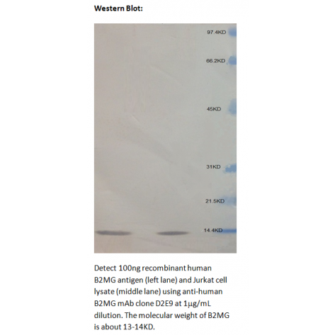 mAb anti-Human B2MG, D2E9, Capture