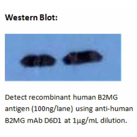 mAb anti-Human B2MG, D6D1
