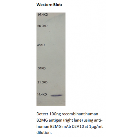 mAb anti-Human B2MG, D2A10