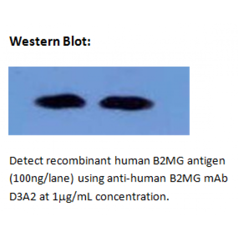 mAb anti-Human B2MG, D3A2, Detector