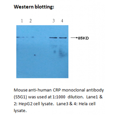 mAb anti-human CRP, S5G1