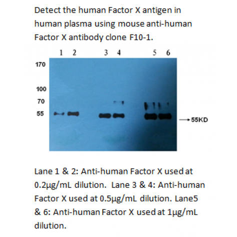 mAb anti-Human Factor X, F10-1, 0.1 mg
