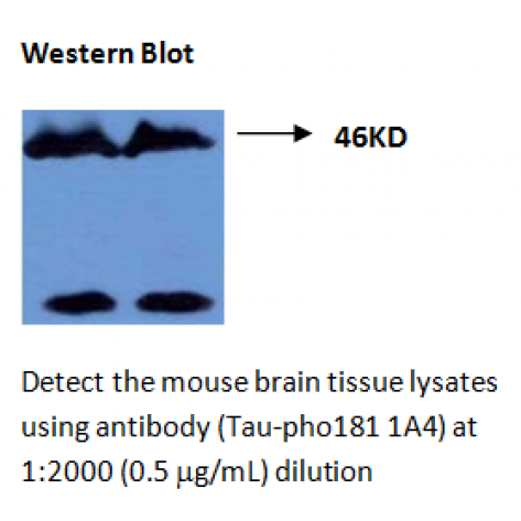 mAb anti-Thr181 Phosphorylated Tau, 1A4