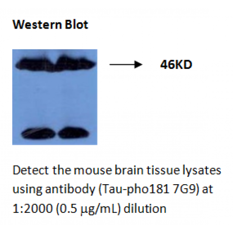 mAb anti-Thr181 Phosphorylated Tau, 7G9