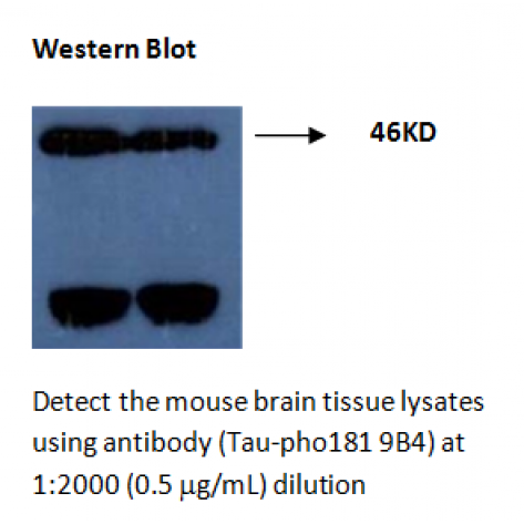 mAb anti-Thr181 Phosphorylated Tau, 9B4