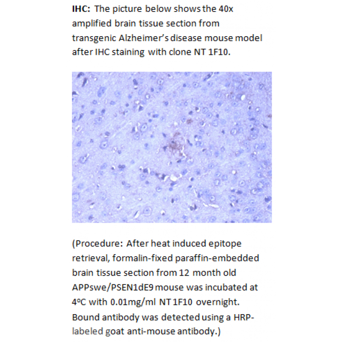 Mab Anti Amyloid B Peptide N Terminal Nt 1f10 In Neurological Disorders Shop By Research Area Root