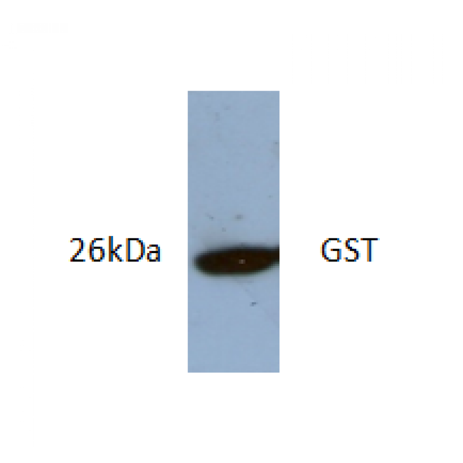 glutathione s-transferase antigen mu 1/GSTM1 Antibody (1H4F2) immunologic histochemical stains. pAb Rabbit anti-Human Glutathione S